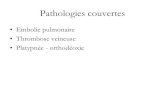 Embolie pulmonaire Thrombose veineuse Platypn£©e - orthod£© 3D ULB/20-05-18 Embolie...¢  2020. 5. 18.¢ 