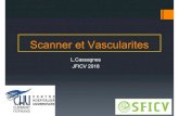 Scanner et Vascularites - JFICV · maladie infectieuse, une pathologie néoplasique, post-médicamenteuse. classification Vascularites primitives : Vaisseaux de gros calibre Mal de