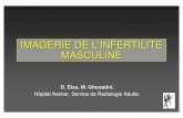 IMAGERIE DE L’INFERTILITE MASCULINEstephanelarre.free.fr/PDF/11.pdf · 2005. 2. 6. · • microlithiase testiculaire 3 grades-1: 1-10 µlithiases-2: 10-20 µlithiases-3: > 20 µlithiases