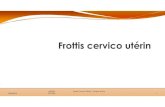 AHFMC Frottis Cervico Utérin -Docteur Sylvie SOTTER 1...CAT devant une femme ayant une cytologie CU anormale Recommandations INCA 12/2016 3,9% FCU anormaux: 235 000 patientes, 31