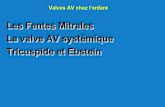 Les Fentes Mitrales La valve AV systémique Tricuspide et ......Nom Taille Mit/Aort. anneau tissu orifice interne hors-tout géométrique effective mitrale 1 2 4 (calculée) (mesurée)