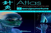 Atlas photographique d'acupunctureekladata.com/.../Q072_Brochure_atlas_FR.pdfDr Antoine Bereder Atlas photographique d’acupuncture L a motivation principale, pour créer cet Atlas