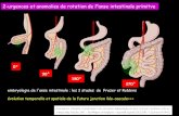 0° 180° 270°onclepaul.net/wp-content/uploads/2011/07/volvulus-du... · 2017. 3. 23. · embryologie de l'anse intestinale ; les 3 stades de Frazer et Robbins évolution temporelle