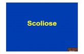 Scoliose - Overblogddata.over-blog.com/0/10/54/33/Orthopedie2011/Scoliose.pdfUne scoliose est une courbure vertébrale structurale qui ne disparaît pas quand on corrige l’inclinaison