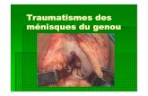 Traumatismes des ménisques du genou...Traumatismes des ménisques du genou II--OBJECTIFS OBJECTIFS-- Connaitre les lésions Connaitre les lésions anatomopathologiques des ménisques