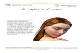 Rhinoplastie - Ouverte - Ocean Clinic...Rhinoplastie - Ouverte Le remodelage du nez, ou la rhinoplastie est une des procédures de chirurgie esthétique la plus communément pratiquée
