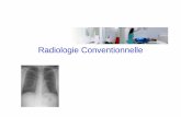 ISIS SB 2A02 RadiologieConventionnelle 2008newmimik.free.fr/hihi/SB/ISIS_SB_2A02_Radiologie... · 2008. 4. 4. · • De plus, la radiologie déforme les objets et ne reproduit pas