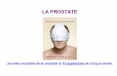 LA PROSTATE - REF67ref67.fr/images/reunions/reunion_vero_sept2012/LA... · 2018. 2. 9. · HYPERTROPHIE DE LA PROSTATE L’adénome, ou hypertrophie bénigne de la prostate (HBP),