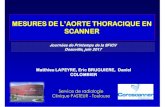 MESURES DE L’AORTE THORACIQUE EN SCANNER · 2017. 11. 24. · Anévrisme de l’aorte thoracique ascendante (AATA) 2 types Al-Attar N -Presse Med 2010 -Anévrismes de l'aorte thoracique
