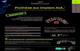 Prothèse sur implant ANA. Prothèse sur implant Polissage ... ... Prothèse sur implant ANA.®. Les restaurations transvissées hybrides sont un choix de qualité en remplacement