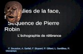 Anomalies de la face, fentes Séquence de Pierre Robin