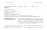 Subepithelial connective tissue graft: a case report