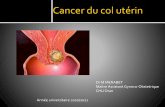 Cancer du col utérin