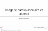 Imagerie cardiovasculaire et scanner