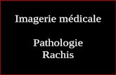 Imagerie médicale Pathologie Rachis