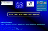 MESOTHELIOME PLEURAL MALIN - AP-HM