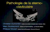 Pathologie de la sterno- claviculaire - ClubOrtho.fr