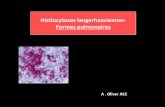 Histiocytoses langerhansiennes- Formes pulmonaires
