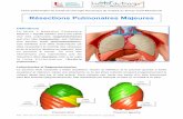 Résections Pulmonaires Majeures - IMM