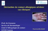 Dermatites de contact allergiques sévères: cas cliniques