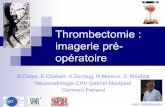 Thrombectomie : imagerie pré-opératoire
