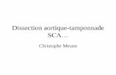 Dissection aortique-tamponnade SCA