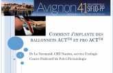 COMMENT J IMPLANTE DES BALLONNETS ACT ET PRO