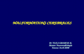 MALFORMATIONS CEREBRALES Dr TLILI-GRAIESS K. Master Neuroradiologie Sousse Avril 2008