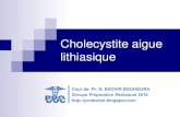 Cholecystite aigue lithiasique