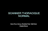 SCANNER THORACIQUE NORMAL - .SCANNER THORACIQUE NORMAL Marie-Pierre Debray, Nicoletta Pasi, Ya«l