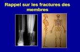 1 fractures generalites