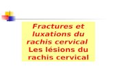 Fractures et luxations du rachis cervical  Les l©sions du rachis cervical